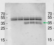 AGB1 | Guanine nucleotide-binding protein beta 1 in the group Antibodies Plant/Algal  / Developmental Biology / Signal transduction at Agrisera AB (Antibodies for research) (AS16 3937)